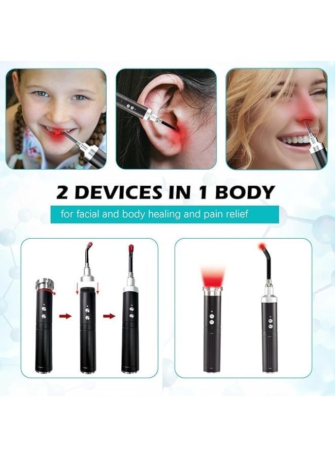 Phototherapy device for relieving cold sores and ulcers. Infrared phototherapy. Suitable for muscle and nerve pain in the lips, ears, knees, and hands. Comes with a detachable probe (black). - Image 2